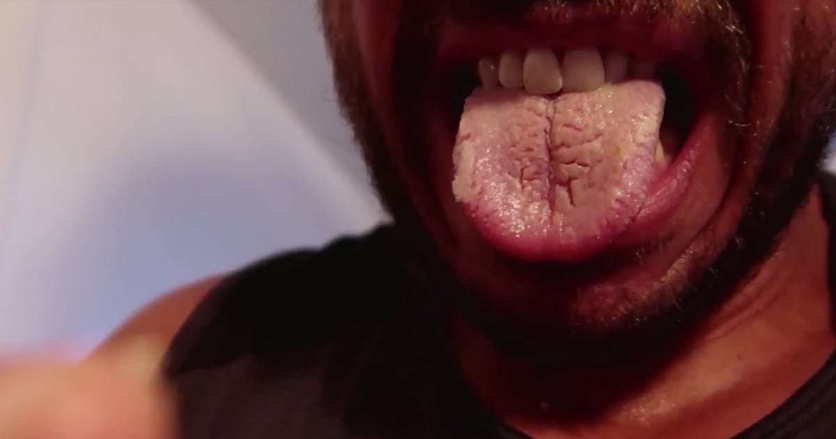 Extreme Swimmer Reveals The Horrifying Phenomenon That Happened To His Tongue During 2,000-Mile Challenge