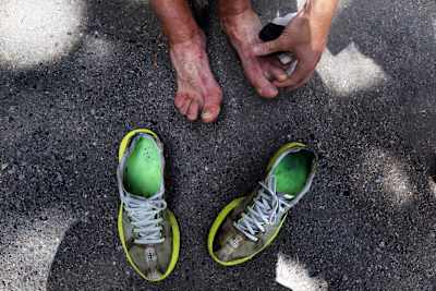 Runners' feet can blister so badly they have to be carried off the course