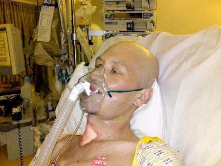 In Feb 2009, James was placed in an induced coma for two weeks