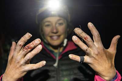 Sasha DiGulian shows her injured fingers after climbing the Platinum route on El Capitan in Yosemite National Park, California, USA on November 26, 2025. 