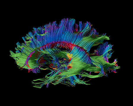Kunst im Kopf: Magnetresonanz macht Nervenfasern im Gehirn sichtbar.