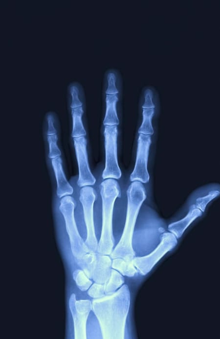 These X-Rays made bones visible and, therefore, easier to examine