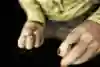 Du siehst richtig, Tommy Caldwell fehlt ein Finger