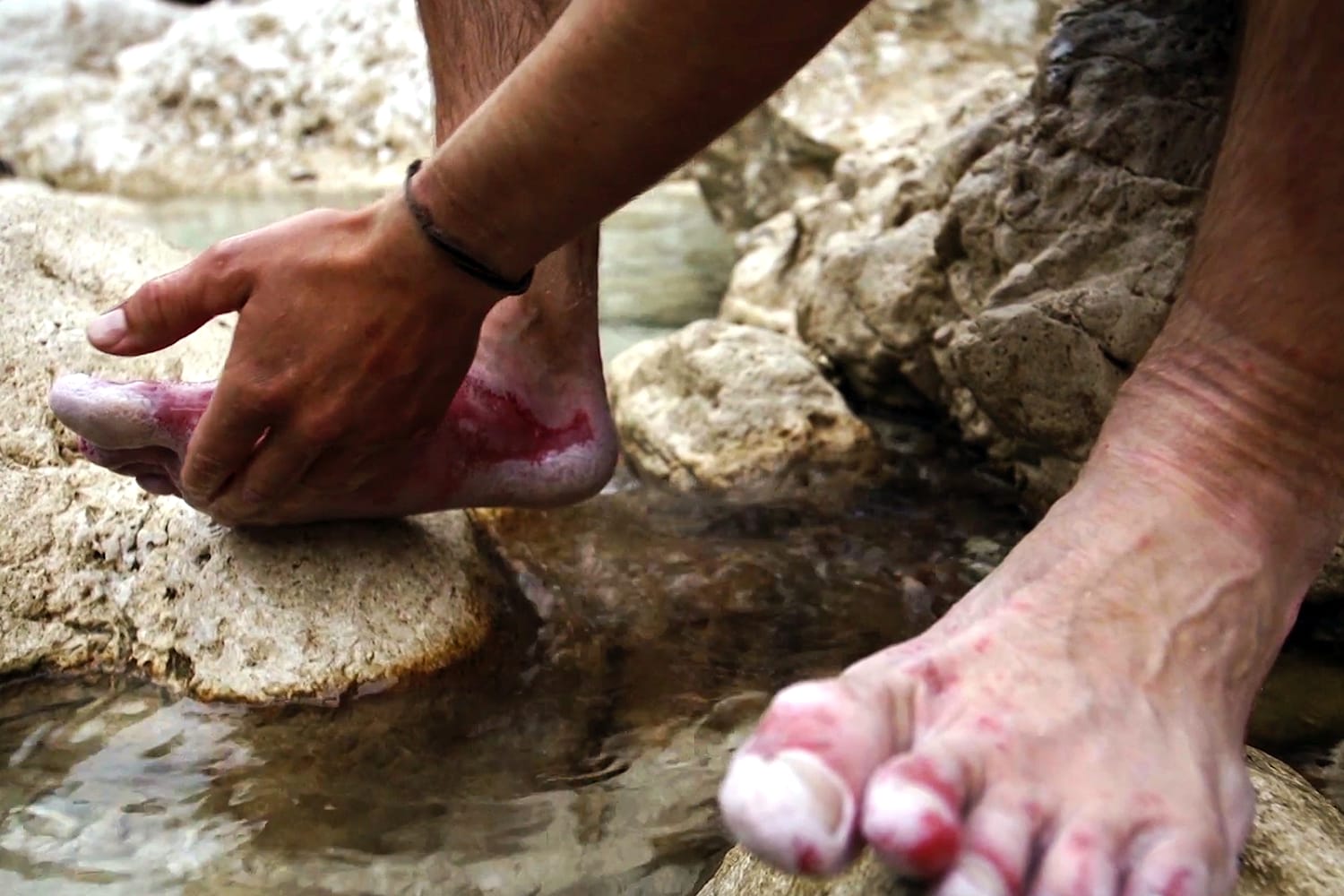 Foot Rot