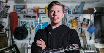 Dan Melville, the gamer with the Deus Ex bionic arm.