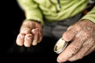 Du siehst richtig, Tommy Caldwell fehlt ein Finger