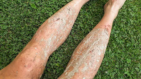 Tlustá vrstva bláta nohy chránila před infekcí