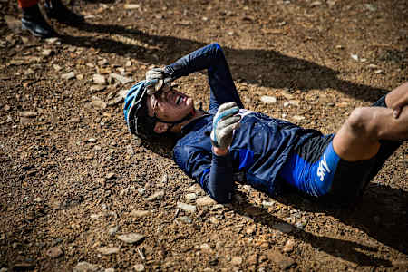 Injured biker after an accident.