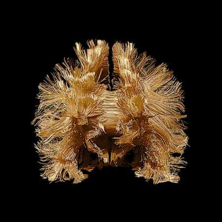 Hier zu sehen: Die Hauptfaserverbindungen im gesamten Gehirn von vorne.