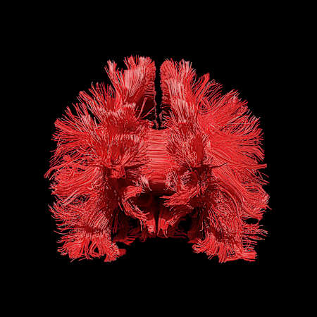Ein weiteres Magnetresonanz-Kunstwerk von Hussong und Stämpfli in Rot