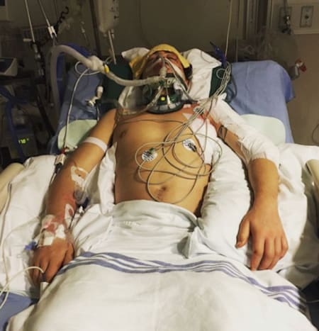 正处于ICU病房的马克