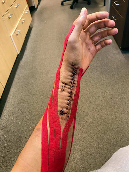 Throughout 2017, Ken Roczen’s Instagram feed offered an unfiltered account of his recovery.